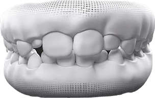 Adult & Baby Teeth Mixed